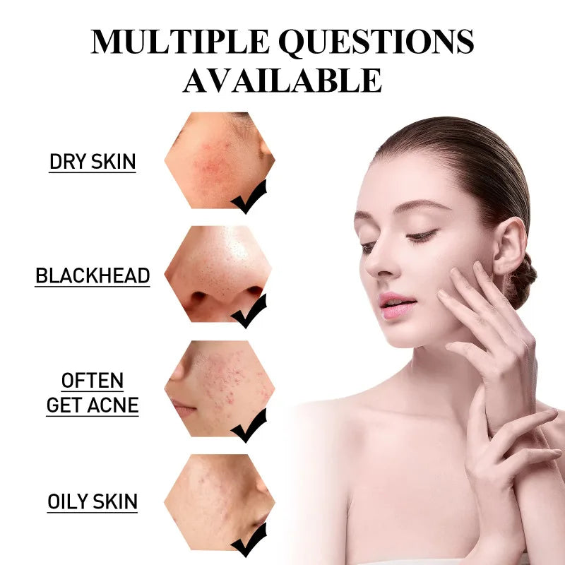 Masque dissolvant de points noirs, nettoyeur de peau au charbon de bois, contrôle de l'huile, anti-ac-ne, pores, rétrécissement, supporter fiant, argile, livres profonds, anciers de masque solide