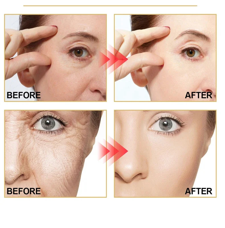 Crème anti-rides au rétinol pour le visage, raffermissante, Anti-vieillissement, estompe les ridules, hydratante, blanchissante, réparation, soins pour la peau, cosmétiques