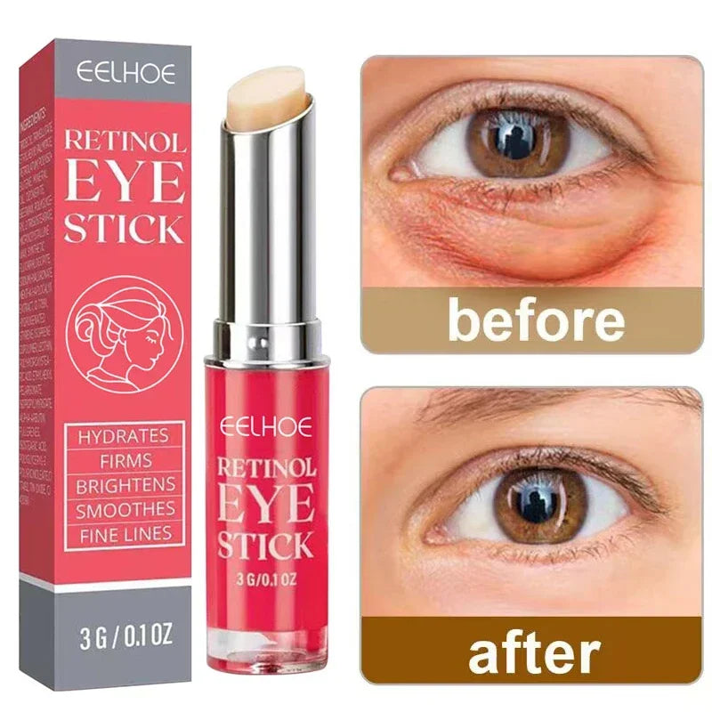 Crème Anti-rides pour les yeux, rétinol, élimine les poches oculaires, Anti-vieillissement, Lifting, raffermissant, blanchissant, hydratant, éclaircissant, soins pour la peau