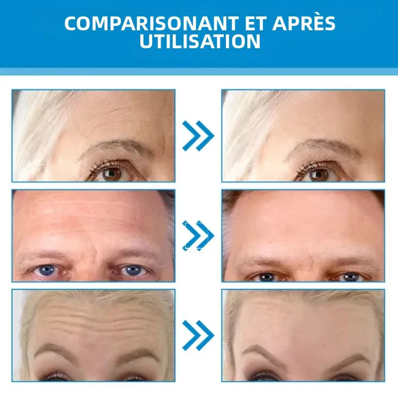 5 pièces/ensemble patchs Hydrogel Film Anti rides supprimer les cernes nourrir masque hydratant ascenseur raffermissant peau yeux front soin