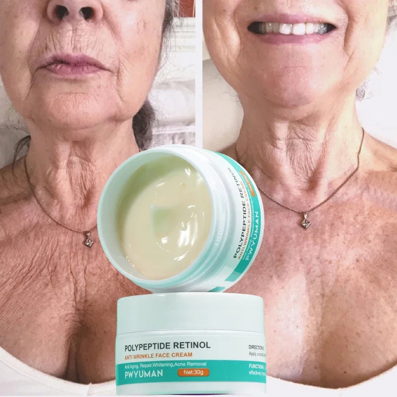 Crème anti-rides au rétinol pour le visage, raffermissante, Anti-vieillissement, estompe les ridules, hydratante, blanchissante, réparation, soins pour la peau, cosmétiques