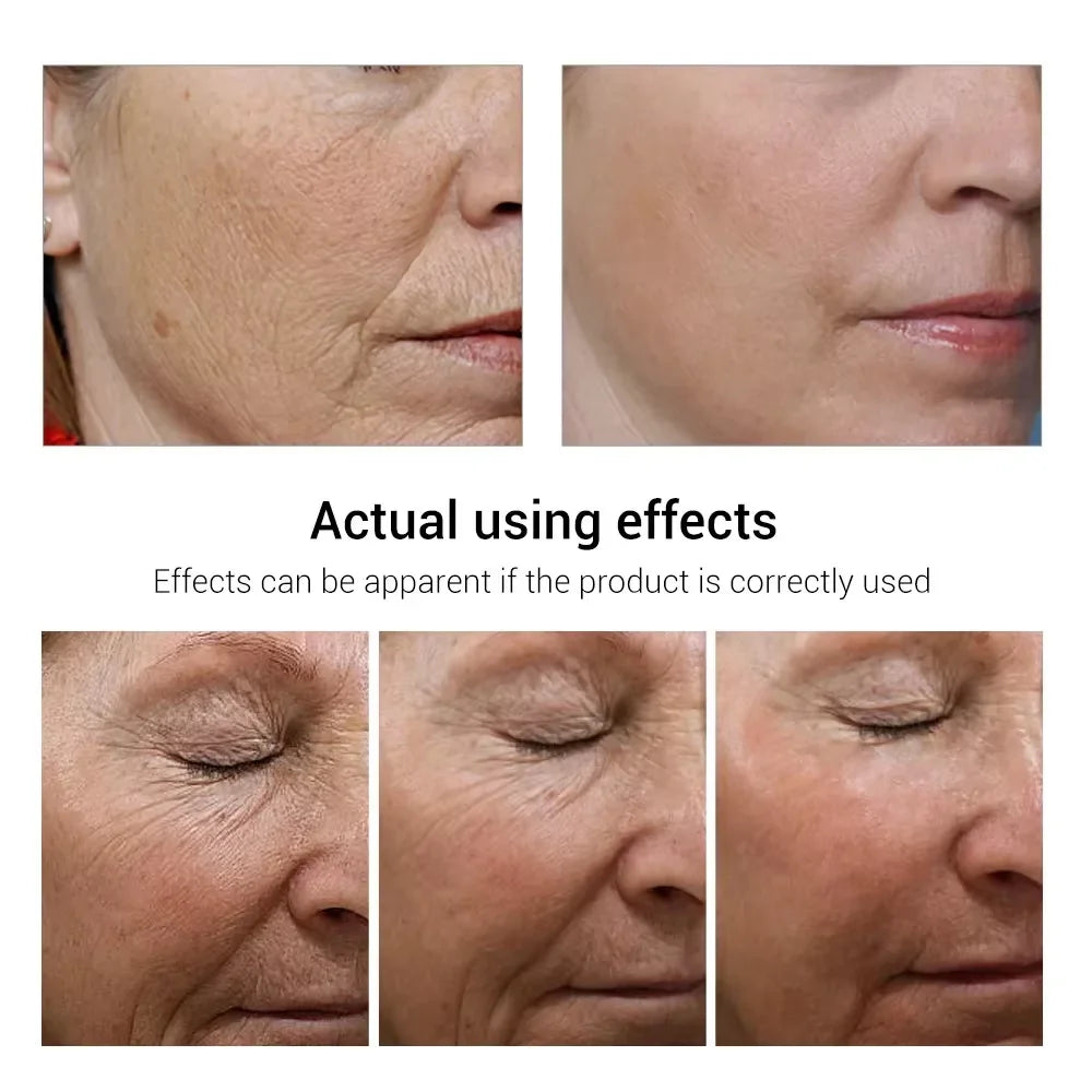 Crème anti-rides au rétinol pour le visage, raffermissante, Anti-vieillissement, estompe les ridules, hydratante, blanchissante, réparation, soins pour la peau, cosmétiques