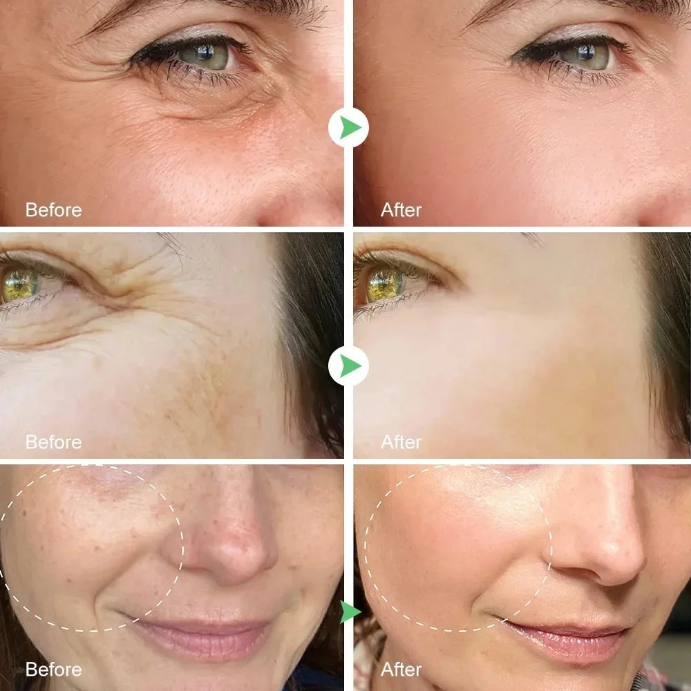 Crème anti-déformable pour le visage, effet instantané, anti-âge, améliore les ridules, nourrissante, soins de la peau, nouveau