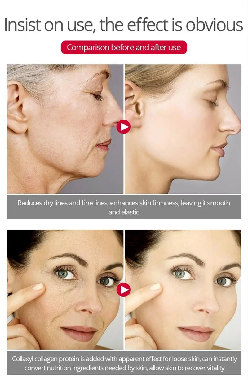 Crème anti-déformable pour le visage, effet instantané, anti-âge, améliore les ridules, nourrissante, soins de la peau, nouveau