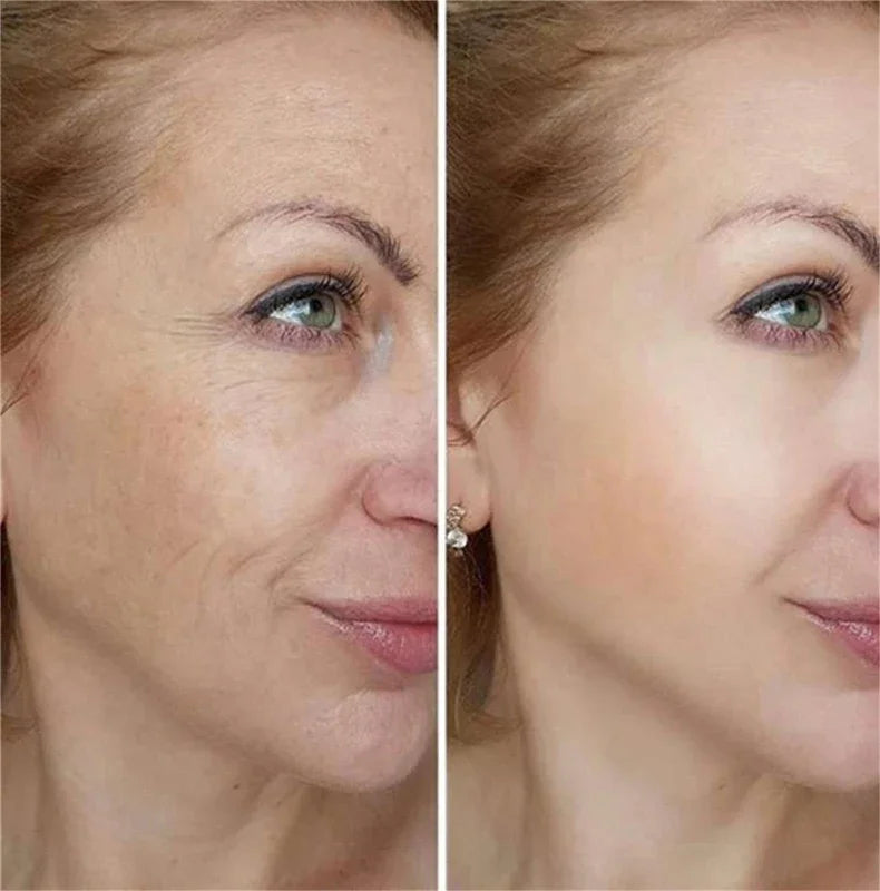 Crème anti-rides au rétinol pour le visage, raffermissante, Anti-vieillissement, estompe les ridules, hydratante, blanchissante, réparation, soins pour la peau, cosmétiques