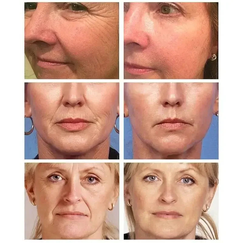 Crème anti-rides au rétinol pour le visage, raffermissante, Anti-vieillissement, estompe les ridules, hydratante, blanchissante, réparation, soins pour la peau, cosmétiques