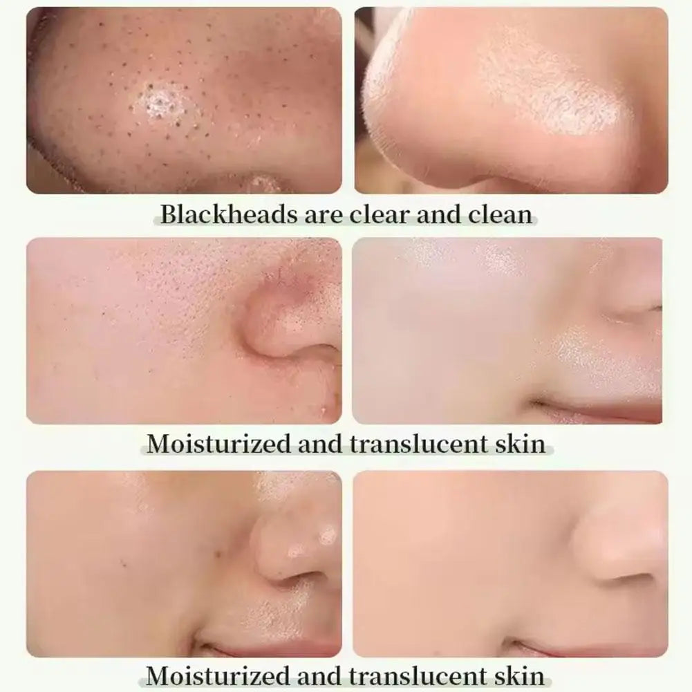 Bâton d'argile à thé vert pour le visage, bâton de masque vert, frottis d'acné, rétrécit les points noirs, extrait de thé vert, masque Facial, nettoyage des pores, 1/3 pièces