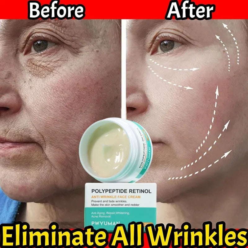 Crème anti-rides au rétinol pour le visage, raffermissante, Anti-vieillissement, estompe les ridules, hydratante, blanchissante, réparation, soins pour la peau, cosmétiques