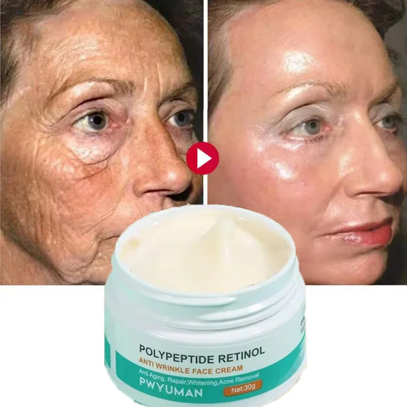 Crème anti-rides au rétinol pour le visage, raffermissante, Anti-vieillissement, estompe les ridules, hydratante, blanchissante, réparation, soins pour la peau, cosmétiques