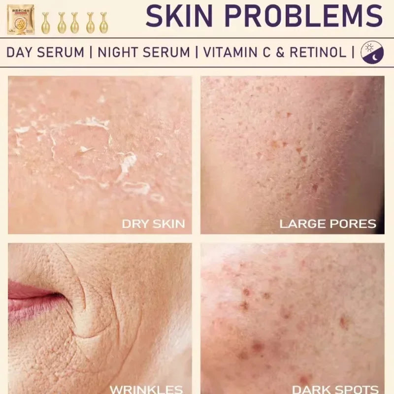 Capsules de sérum à l'acide hyaluronique pour le visage, élimine les taches de réparation, blanchit, anti-déformable, sans âge, optimiste, soins de la peau, cosmétiques, nouveau