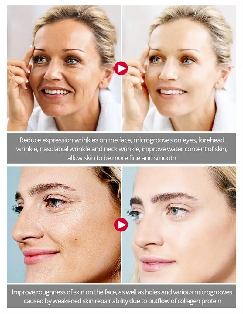 Crème anti-déformable pour le visage, effet instantané, anti-âge, améliore les ridules, nourrissante, soins de la peau, nouveau