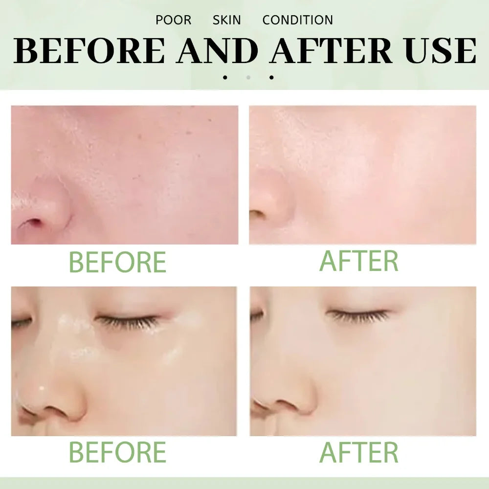 Masque facial solide nettoyant au thé vert, bâton nettoie les Pores, élimine l'acné, points noirs, contrôle de l'huile, éclaircit, hydratant, beauté, ensemble pour la peau
