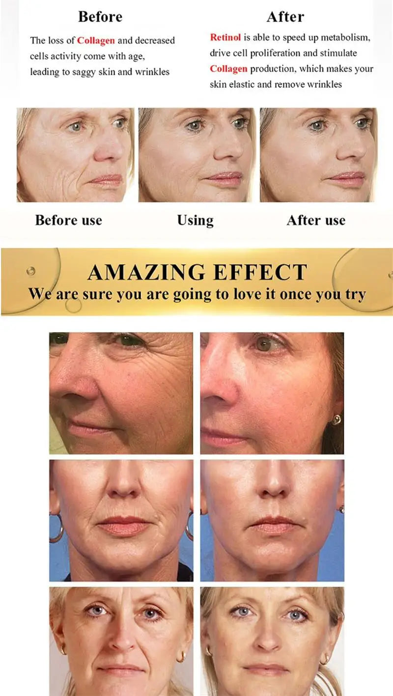 Crème anti-déformable pour le visage, effet instantané, anti-âge, améliore les ridules, nourrissante, soins de la peau, nouveau