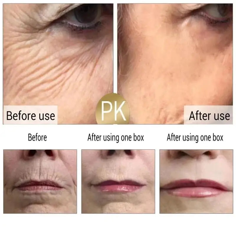 Crème anti-rides au rétinol pour le visage, raffermissante, Anti-vieillissement, estompe les ridules, hydratante, blanchissante, réparation, soins pour la peau, cosmétiques