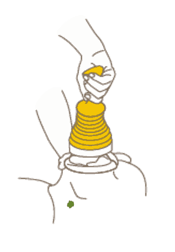 Anti-etouffement respiratoire, pulmonaire, Fonction dispositif anti-suffocation